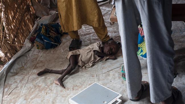 UNICEF says some 49,000 children will die of malnutrition in Nigeria