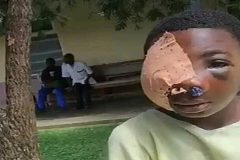 Biya’s war crimes exposed