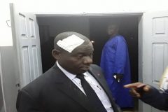 Hon. Richard Wallang’s health: A CPDM volcano about to erupt