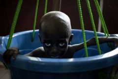 The battle to save Central African Republic’s starving children