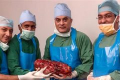 Indian doctors remove giant 7.4 kilo kidney from man