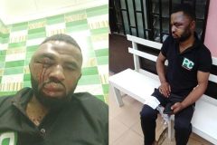 Cameroon Web reporter Paul Chouta assaulted again in Yaoundé by Secret Service agents
