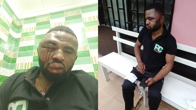 Cameroon Web reporter Paul Chouta assaulted again in Yaoundé by Secret Service agents