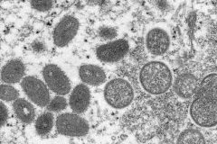 Monkeypox Yaoundé intensifies Mpox response amid growing outbreak